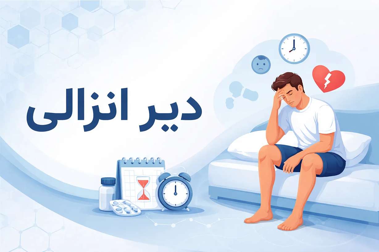 دیر انزالی